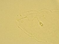 Pilatobius oculatus image