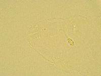 Pilatobius oculatus image