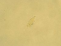 Pilatobius oculatus image