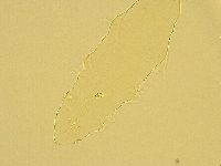 Pilatobius oculatus image