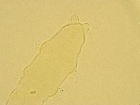 Pilatobius oculatus image