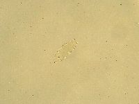 Pilatobius oculatus image