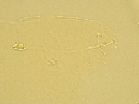 Pilatobius oculatus image