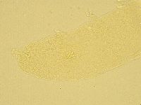 Pilatobius oculatus image