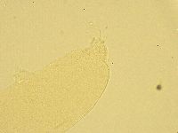 Pilatobius oculatus image