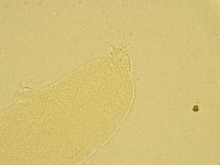 Pilatobius oculatus image