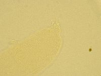 Pilatobius oculatus image