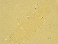 Pilatobius oculatus image