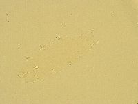 Pilatobius oculatus image