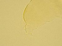 Pilatobius oculatus alpinus image