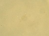 Pilatobius oculatus alpinus image