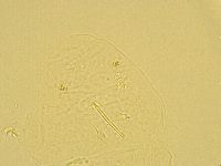 Pilatobius oculatus alpinus image