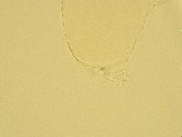 Pilatobius oculatus alpinus image