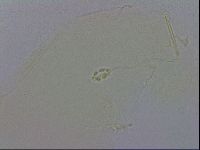 Pilatobius oculatus alpinus image