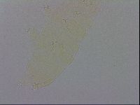 Pilatobius oculatus alpinus image