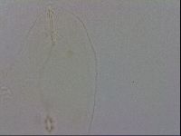 Pilatobius oculatus alpinus image