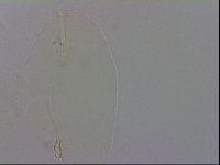 Pilatobius oculatus alpinus image