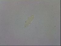 Pilatobius oculatus alpinus image