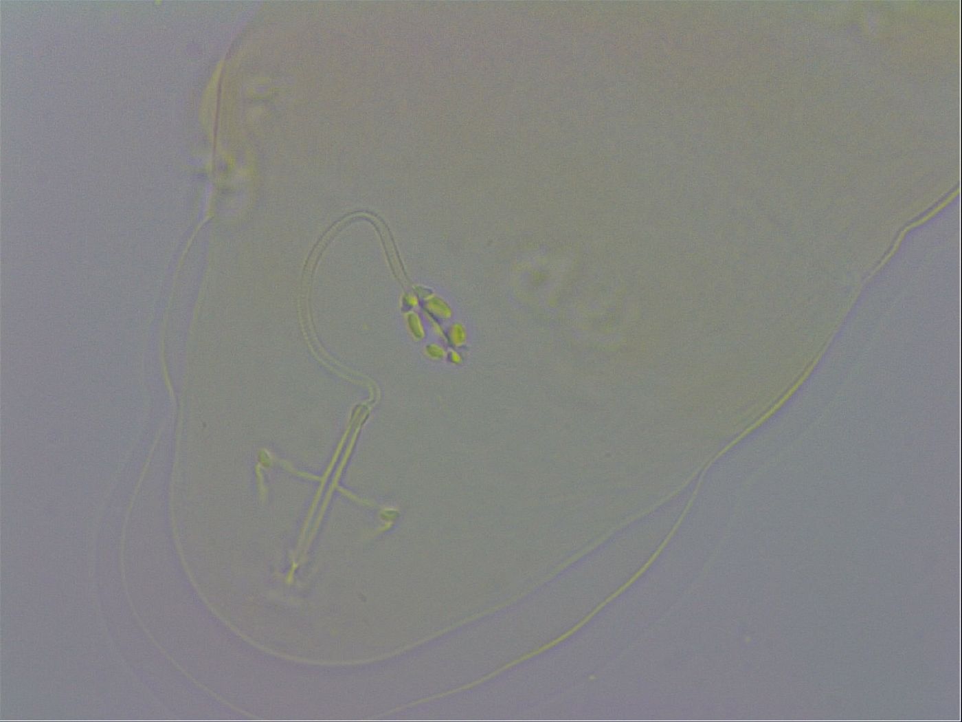 Pilatobius oculatus alpinus image