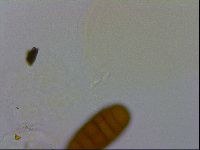 Pilatobius oculatus alpinus image