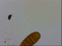 Pilatobius oculatus alpinus image