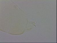 Pilatobius oculatus image
