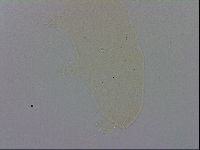 Pilatobius oculatus alpinus image