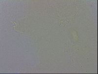 Pilatobius oculatus image