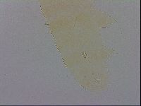 Pilatobius oculatus image