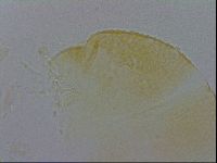 Pilatobius oculatus image