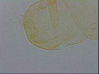 Pilatobius oculatus image