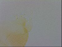 Pilatobius oculatus image