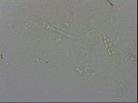 Adropion prorsirostre image