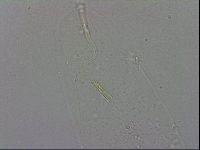 Adropion prorsirostre image