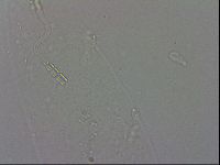 Adropion prorsirostre image