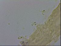 Adropion scoticum image