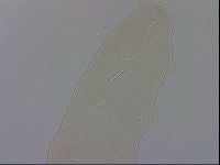 Mesocrista spitzbergensis image