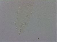 Mesocrista spitzbergensis image
