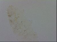 Mesocrista spitzbergensis image