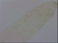 Media resource of Mesocrista spitzbergensis