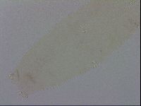 Mesocrista spitzbergensis image
