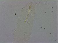 Mesocrista spitzbergensis image