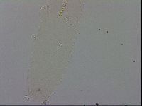 Mesocrista spitzbergensis image
