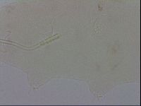 Mesocrista spitzbergensis image
