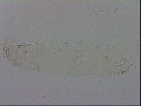 Mesocrista spitzbergensis image