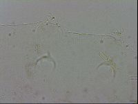 Mesocrista spitzbergensis image