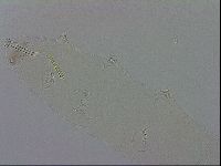 Mesocrista spitzbergensis image