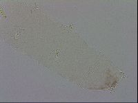 Mesocrista spitzbergensis image