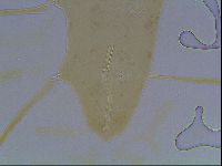 Mesocrista spitzbergensis image