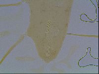 Mesocrista spitzbergensis image